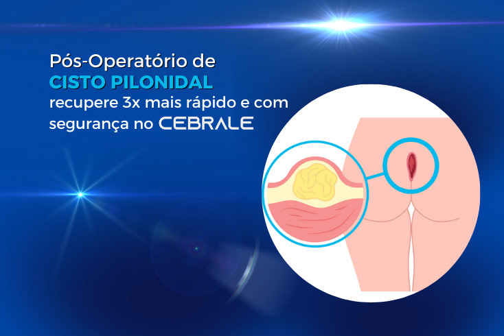 pós-operatório de cisto pilonidal